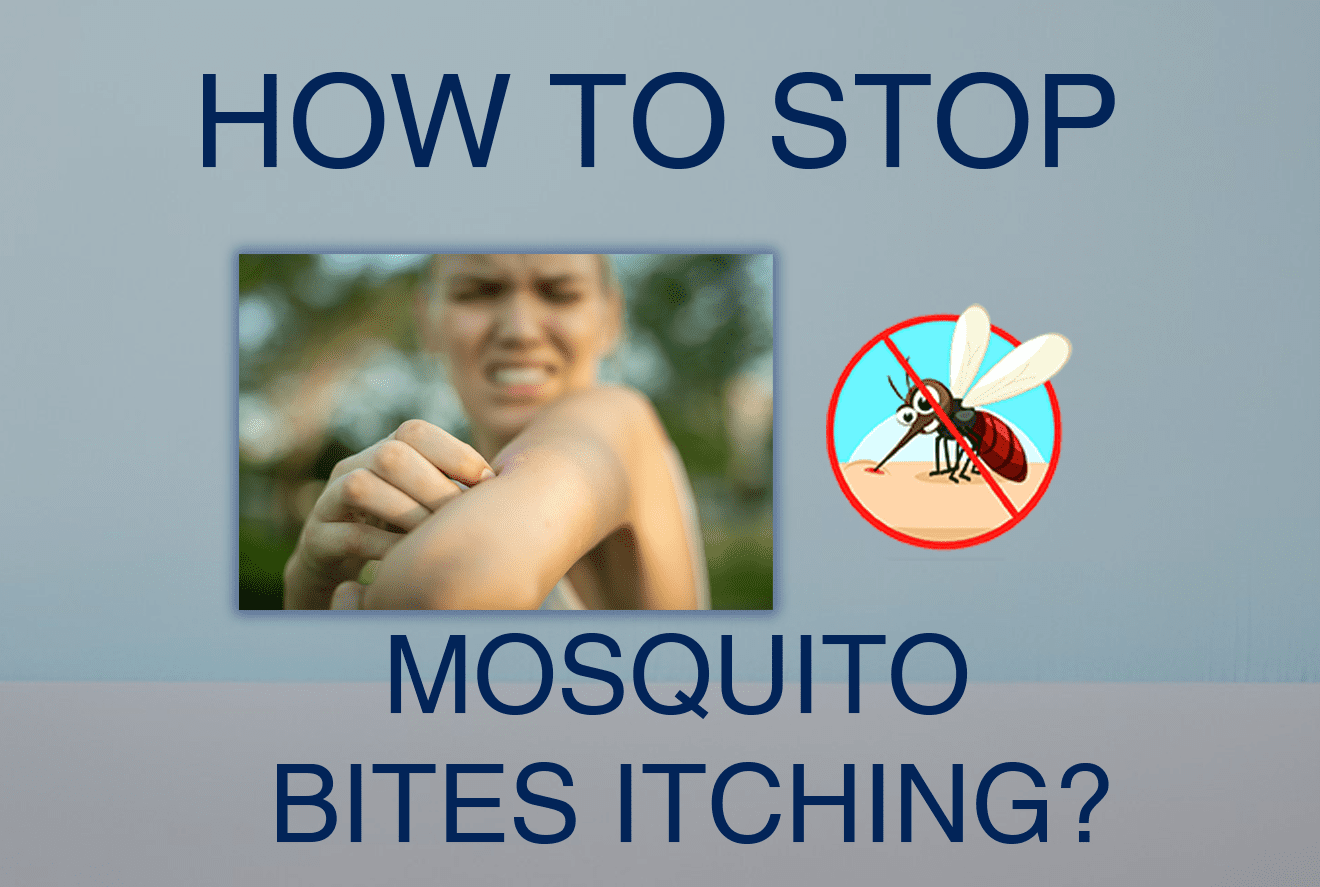 How Do I Stop Mosquito Bites From Itching Mosquito Bites Relief 